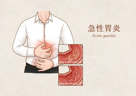 胃肠动力治疗仪 胃肠动力治疗仪